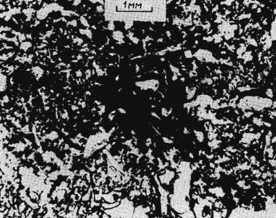 Рис. 3. Микрофотография шлифа обломка гиалокластита из юго-восточной части Тихого океана. Видны темные сегрегационные выделения железо-марганцевых окислов, широко рассеянные в сидеромелан-палагонитовой массе.