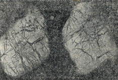 Рис. 179. Радиография двух приполированных образцов уранинита с прожилками тухолита (черное)